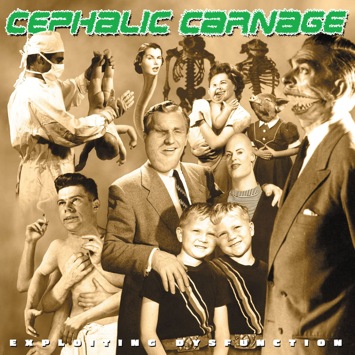 Cephalic Carnage - Exploiting Dysfunction album cover